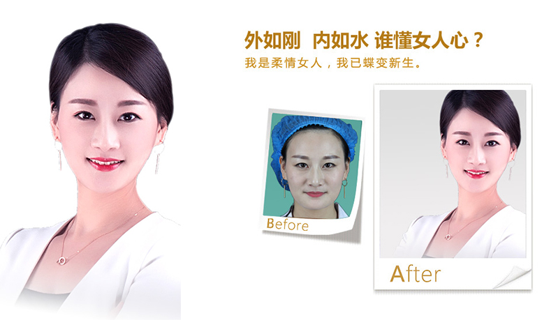 洛阳V脸、线雕隆鼻